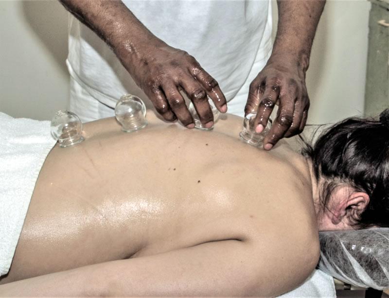 cupping